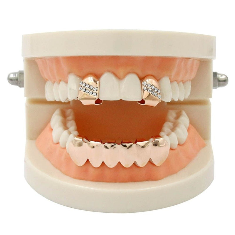 Iced 2 Single Top Tooth Caps + 6 Tooth Bottom Grillz 14K - ICECI